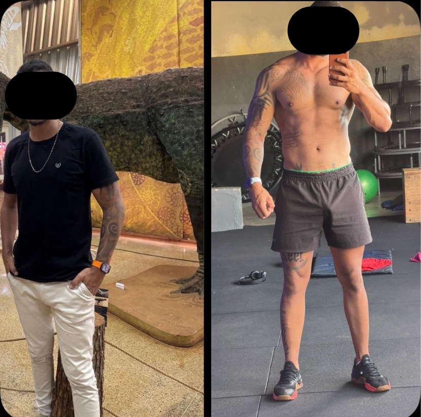Antes e Depois de Paciente - Transformação Corporal