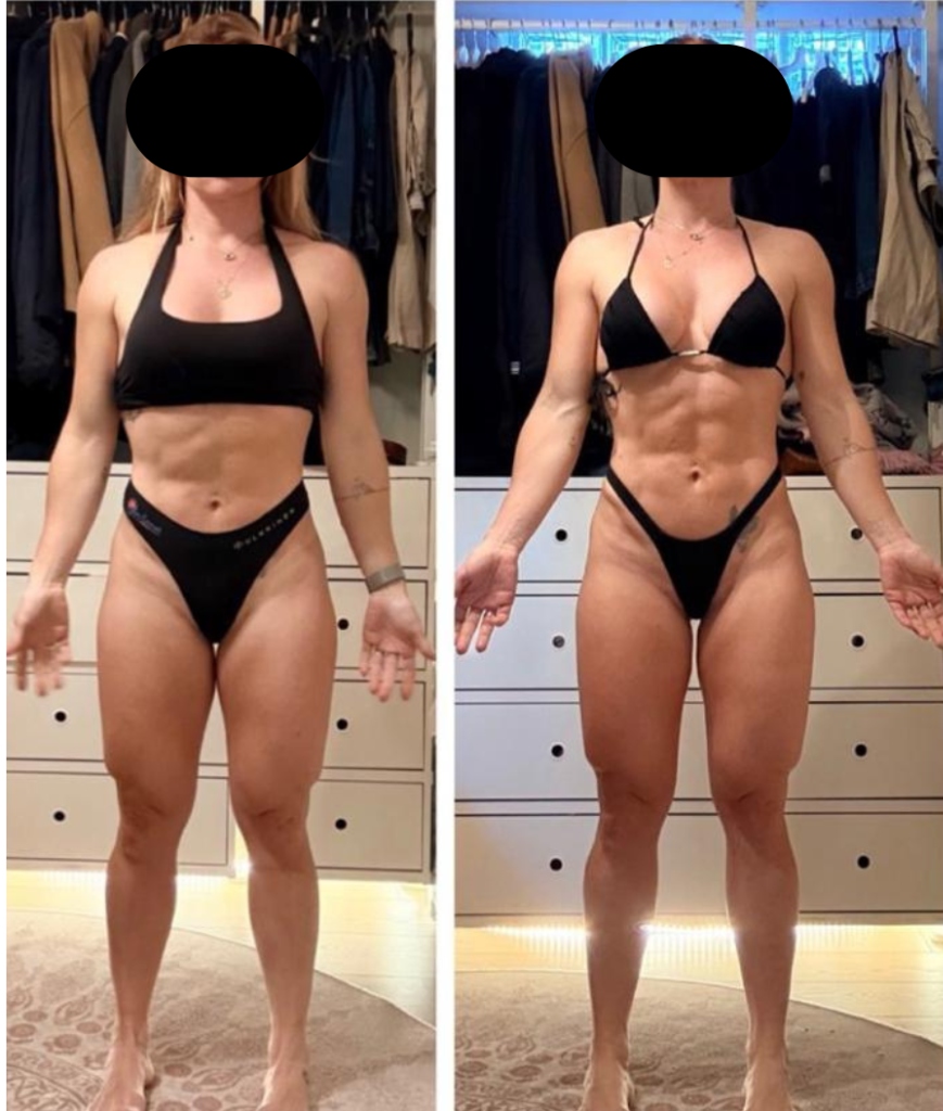 Antes e Depois de Paciente - Emagrecimento e Hipertrofia